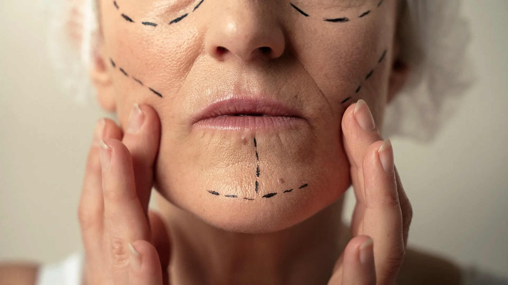Procedimientos de cirugía estética facial en Mérida