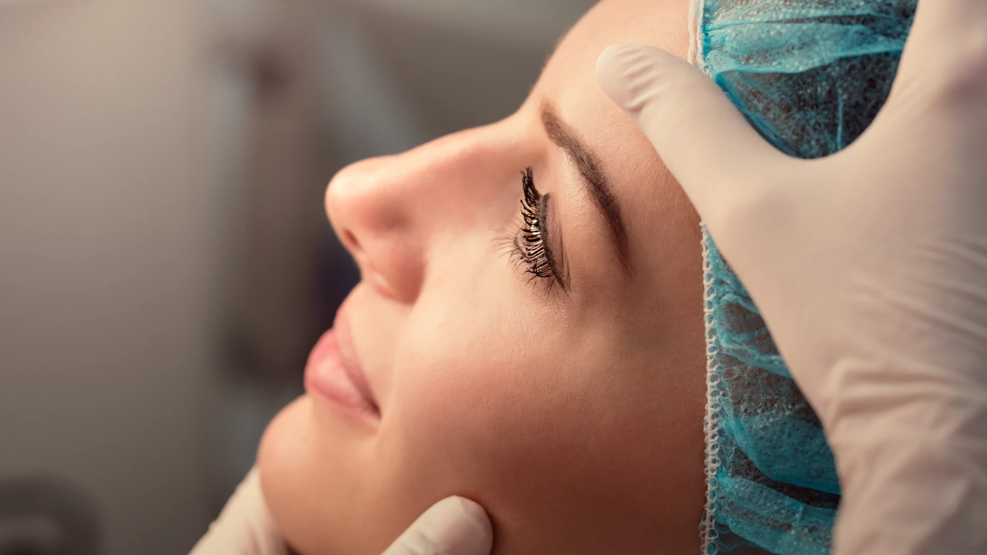 Rinoplastia estética y funcional realizada en Mérida